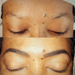 microshading