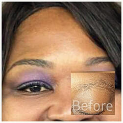 microshading