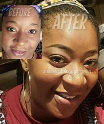Microshading Healed Results